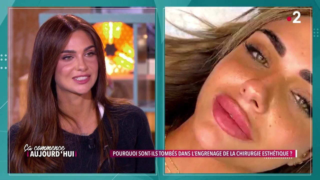 Nathanya Les Anges Explique Sa D Cision Radicale Sur Son Changement