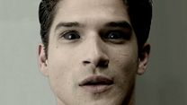 image de Teen Wolf - saison 5 TEASER VO "Operating Table"