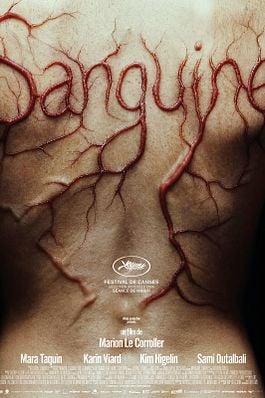 Sanguine