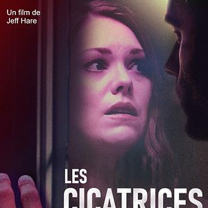 Photo Les cicatrices du passé
