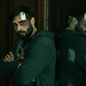 Photo Trauma