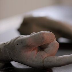Photo Survivre à la mort