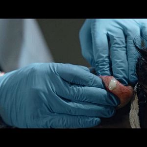 Photo Cyst