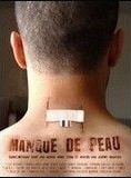 Manque de peau