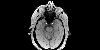 poster de la série Le Cerveau décodé