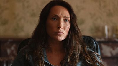 image de la news Surface sur France 2 : "J'ai entendu les os de mon crâne se briser", découvrez l'histoire vraie qui a inspiré la série avec Laura Smet