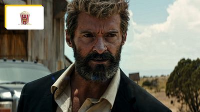 image de la news 70 points de suture, fracture au cou... 5 acteurs qui gardent des séquelles permanentes après un rôle