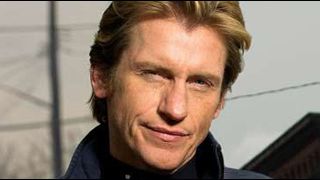 image de la news Denis Leary s'enflamme pour un drama médical