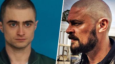 image de la news Ils se sont rasé le crâne pour un rôle...