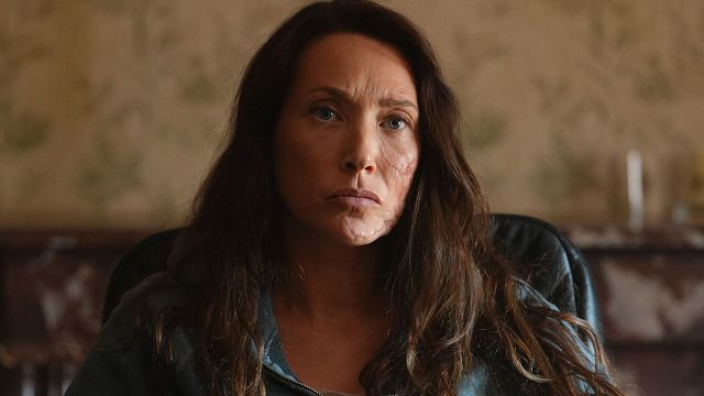 image de la news Surface sur France 2 : "J'ai entendu les os de mon crâne se briser", découvrez l'histoire vraie qui a inspiré la série avec Laura Smet