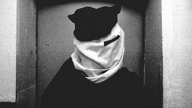 image de la news Elephant Man : le film a l'un des plus beaux maquillages du cinéma mais a été ignoré par les Oscars