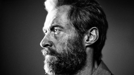 image de la news Logan : Wolverine cicatrise mal sur la nouvelle photo